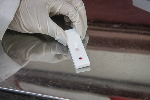 SSH dispone de pruebas de detección rápidas para VIH