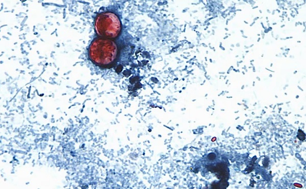 Cofepris no detecta Cyclospora en muestras de 16 hoteles de la Riviera Maya