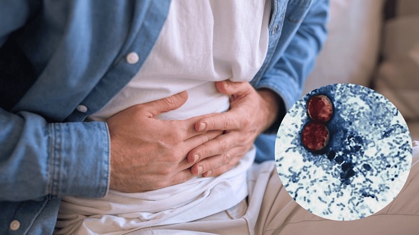 México confirma 33 casos de cyclospora infección que causa diarrea explosiva